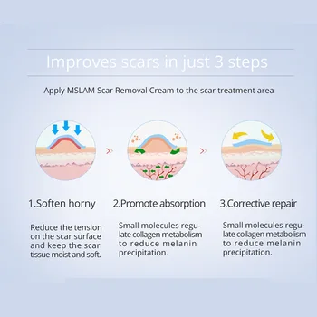 MSLAM Acne Scar Removal Cream Obraz Mozolji Strij Gel Popravilo Glajenje Vlažilne Kirurški Brazgotina Opekline Telo za Nego Kože