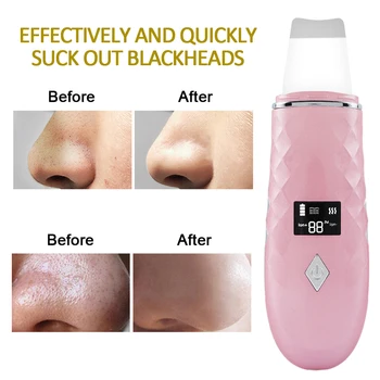 LED Ultrazvočni Kože Scruber Toplejše Facial Cleanser Umazanijo Blackhead Odstranitev Zmanjšanje Gub Lise, Obraz Zob Dvižni Stroj