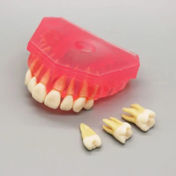 1PC Simulacije Zob Model Zobne Študija Poučevati Standard Demonstracijski Model Ustni Medicinska Izobrazba je Orodje Visoke Kakovosti