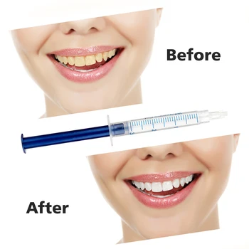 Beljenje zob Komplet 44% Peroksid Zobni Beljenje SystemOral Gel Nastavite Zob Whitener Zobozdravstveno Nego Zob ZDA združeno KRALJESTVO Dropshipping
